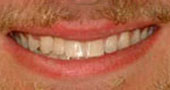 after photo of man smiling